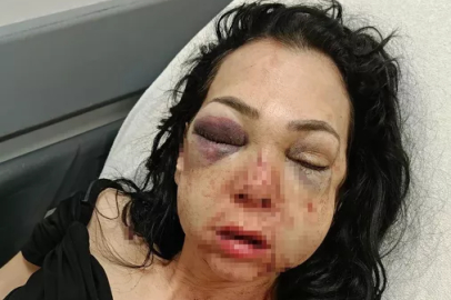 İzmit 'te bir kafe 'de Anne ve oğlu öldüresiye darp edildi